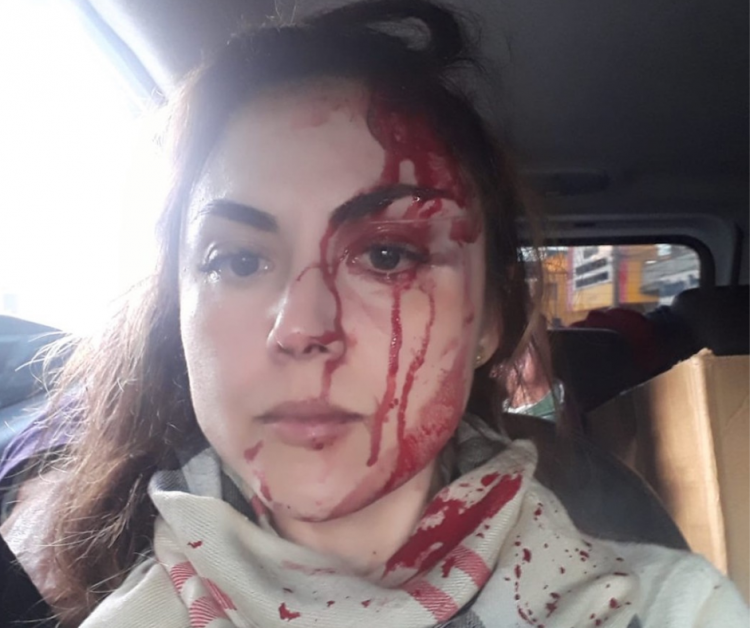 Gabriela Samadello Monteiro de Barros foi agredida por colega de trabalho